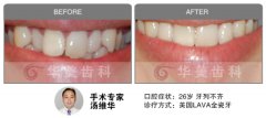 关于老虎牙那些你应知道的事