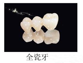 烤瓷牙较便宜会有安全保证吗