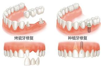 牙齿松动怎么解决